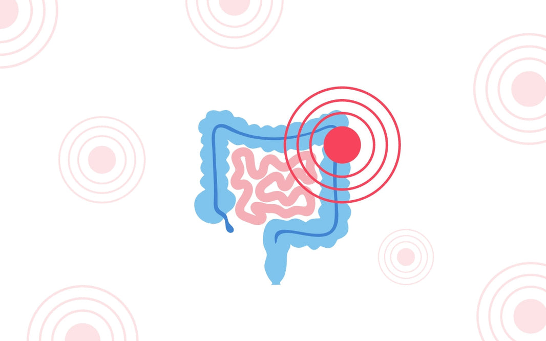 Enfermedades inflamatorias intestinales: Cuando tu intestino se autodestruye