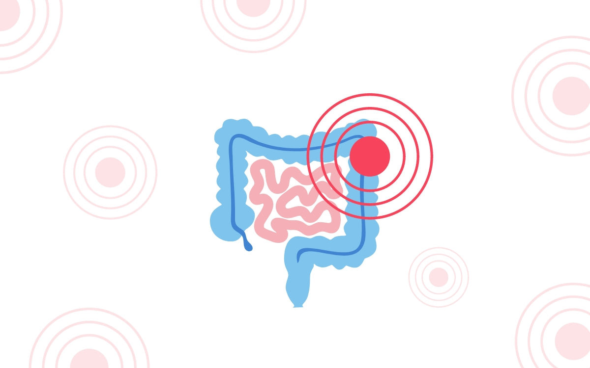 Enfermedades inflamatorias intestinales: Cuando tu intestino se autodestruye