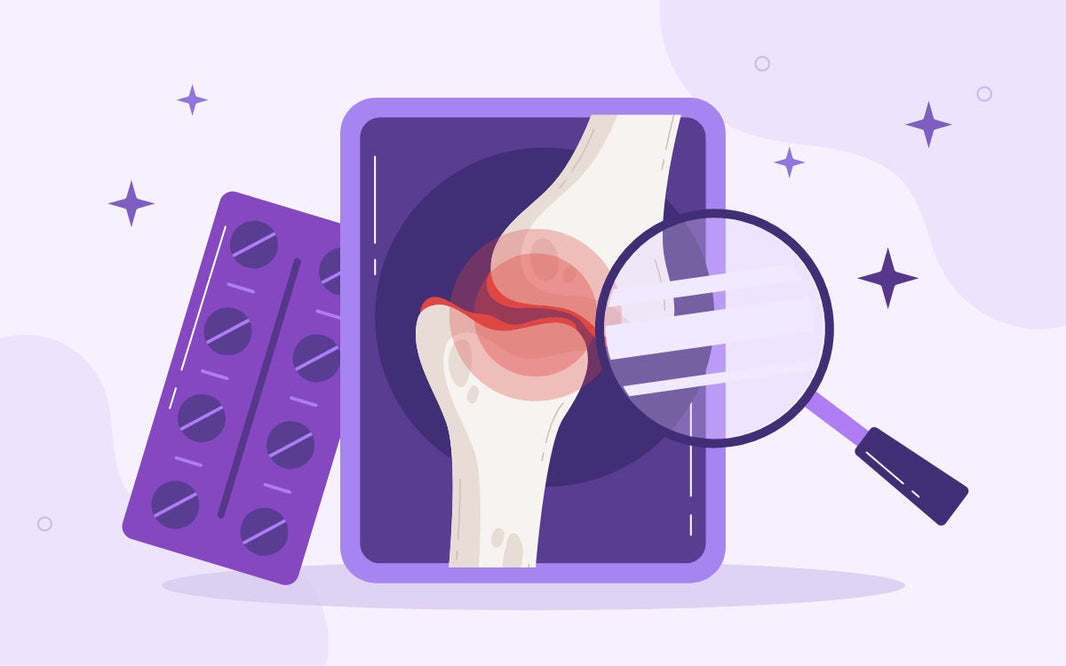 Quedarte sin articulaciones: artritis reumatoide