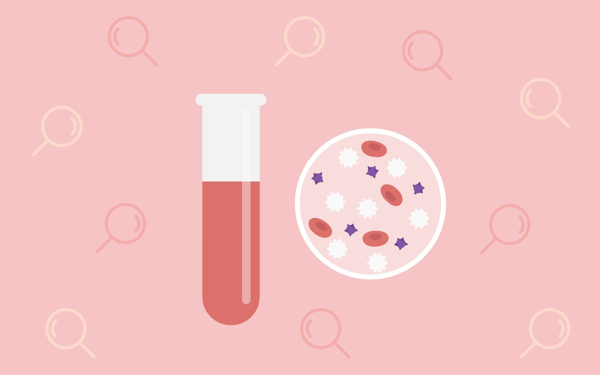 ¿Es hereditaria la leucemia?