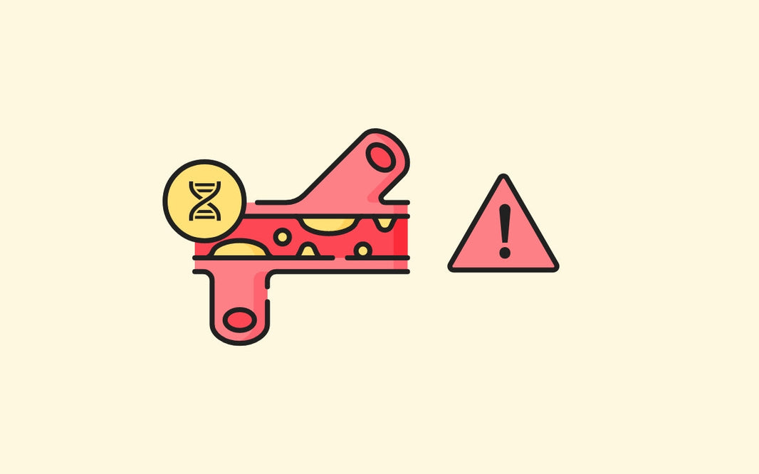 ¿Tengo colesterol? Tu ADN te responderá