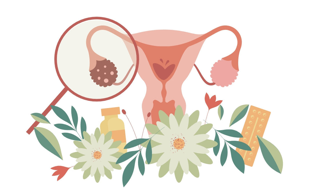 Cáncer de ovario, sutil pero letal