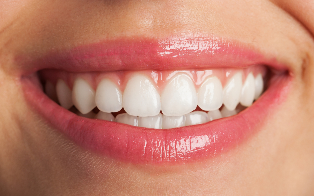 ¿Son las caries hereditarias? El mito de los 'dientes blandos' frente a la realidad de tu ADN