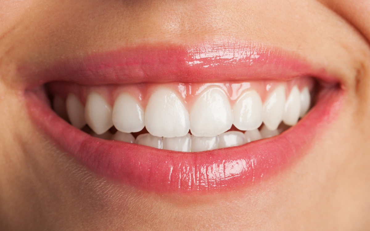 ¿Son las caries hereditarias? El mito de los 'dientes blandos' frente a la realidad de tu ADN